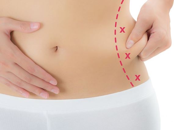 Body Contour